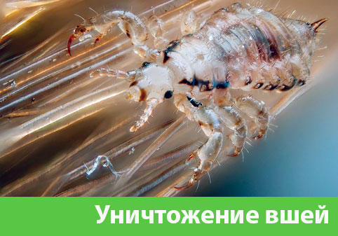 Уничтожение вшей в городе Новокуйбышевск